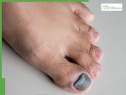 84-Year-Old Hong Kong Man's Skin, Nails Turn Grey: Experts Decode This Strange Health Issue