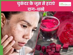 चुकंदर के जूस से हटाएं जिद्दी दाग-धब्बे, बस सप्ताह में 1 बार इन 2 तरीकों से कर लें इस्तेमाल