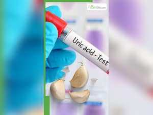 यूरिक एसिड बढ़ने पर लहसुन खाना चाहिए या नहीं?