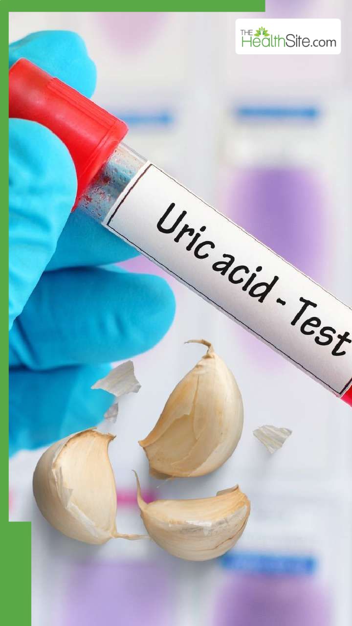 यूरिक एसिड बढ़ने पर लहसुन खाना चाहिए या नहीं?