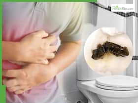 Black Stool Sign: 7 Serious Health Conditions That Can Cause Black Coloured Poop