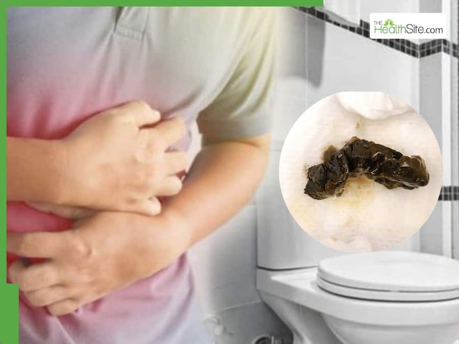 Black Stool Sign: 7 Serious Health Conditions That Can Cause Black