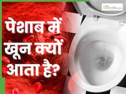 рдЗрди 5 рдЦрддрд░рдирд╛рдХ рдмреАрдорд╛рд░рд┐рдпреЛрдВ рдХреА рд╡рдЬрд╣ рд╕реЗ рдкреЗрд╢рд╛рдм рдореЗрдВ рдЖрддрд╛ рд╣реИ рдЦреВрди, рдпреВрд░рд┐рдирд░реА рдЯреНрд░реИрдХреНрдЯ рдореЗрдВ рдмрдирдиреЗ рд▓рдЧрддреЗ рд╣реИрдВ рдмреНрд▓рдб рдХреЗ рдердХреНрдХреЗ