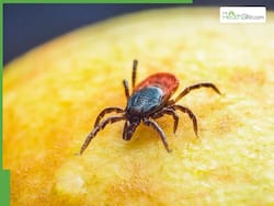 Crimean-Congo Haemorrhagic Fever Kills 51-Year-Old Man From Gujarat: Key Facts About The Disease