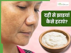 चेहरे से झाइयां हटाने के लिए इन 3 तरीकों से करें दही का इस्तेमाल, निखर उठेगी त्वचा