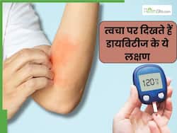 स्किन पर भी दिखते हैं डायबिटीज के ये 5 लक्षण, ना करें इग्नोर, तुरंत मिले डॉक्टर से