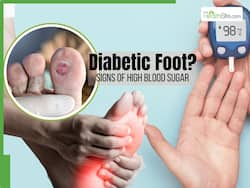 Diabetic Foot and 7 Other Signs of High Blood Sugar Levels in the Body