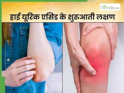 यूरिक एसिड बढ़ने की शुरुआत होते ही कोहनी-घुटने में आता है ये बदलाव, इस हिस्से में होगा तेज दर्द