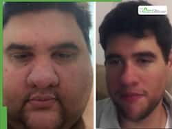 Brazillian Influencer Famous For 174-Kg Weight Loss Transformation Dies Of Heart Attack At 37