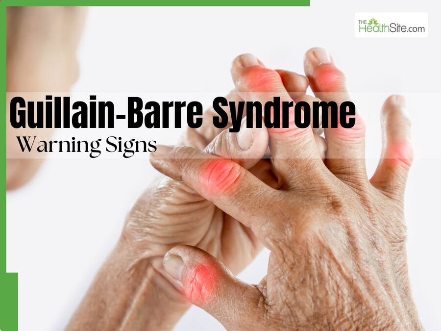 73 Affected with Guillain-Barre Syndrome in Pune: Warning Signs of This Fatal Nerve Disorder