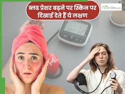 ब्लड प्रेशर बढ़ने पर स्किन में नजर आते हैं ये 5 बदलाव, अधिकतर लोग करते हैं नजरअंदाज 