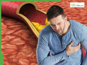 7 Nighttime Habits To Keep High Cholesterol (LDL) Under Control After 10PM