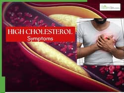 Is Your Cholesterol Too High? 7 Warning Signs of High Cholesterol To Watch Out For