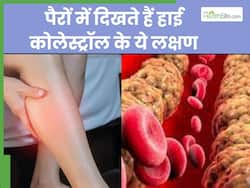 कोलेस्ट्रॉल बढ़ने पर पैरों में दिखाई देते हैं ये 4 संकेत, इग्नोर करने की न करें भूल