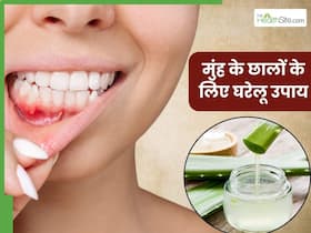 मुंह में हो गए हैं छाले तो आजमाएं ये 5 घरेलू नुस्खे, दर्द और जलन से तुरंत मिलेगी राहत