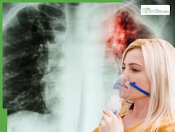 Idiopathic Pulmonary Fibrosis: An Interstitial Lung Diseases That Cannot Be Reversed