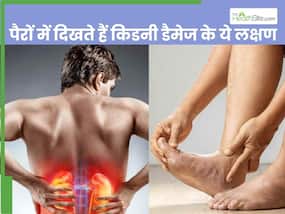 किडनी डैमेज होने से पहले पैरों में दिखाई देते हैं ये 4 लक्षण, इग्नोर करना पड़ सकता है भारी किडनी डैमेज होने से पहले पैरों में दिखाई देते हैं ये 4 लक्षण, इग्नोर करना पड़ सकता है भारी