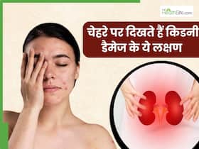 चेहरे पर दिखाई दें ये 5 लक्षण तो समझ जाएं पूरी तरह सड़ चुकी है किडनी, तुरंत भागें डॉक्टर के पास चेहरे पर दिखाई दें ये 5 लक्षण तो समझ जाएं पूरी तरह सड़ चुकी है किडनी, तुरंत भागें डॉक्टर के पास