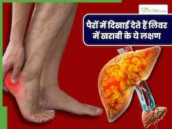 पैरों पर दिखाई देते हैं लिवर में खराबी के ये 5 लक्षण, अधिकतर लोग समझते हैं साधारण