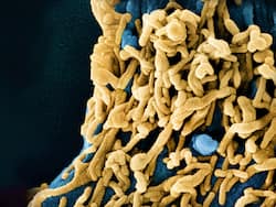 WHO Ramps Up Surveillance To Tackle Marburg Outbreak In Tanzania, Kenya On High Alert Amid Rise In Deaths