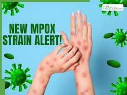 Is There A New Cluster Outbreak Of Mpox 1b Subclade In China?