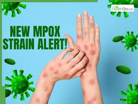 Is There A New Cluster Outbreak Of Mpox 1b Subclade In China? Is There A New Cluster Outbreak Of Mpox 1b Subclade In China?