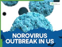 Norovirus Cases Surge In the US: Know The Symptoms, Causes, And How To Protect Yourself