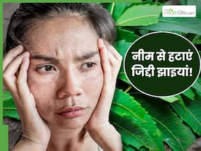 जिद्दी झाइयां हटाने के लिए नीम की पत्तियों का इन 2 तरीकों से करें इस्तेमाल, चेहरे पर आएगा इंस्टेंट निखार जिद्दी झाइयां हटाने के लिए नीम की पत्तियों का इन 2 तरीकों से करें इस्तेमाल, चेहरे पर आएगा इंस्टेंट निखार