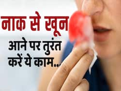 सर्दियों में नाक से खून आने के पीछे ये हैं कारण, कैसे करें बचाव?