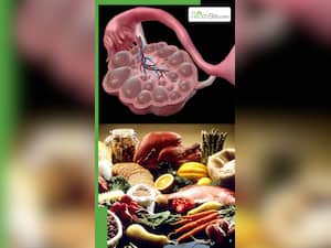 PCOS में भूलकर भी न खाएं ये 7 फूड्स