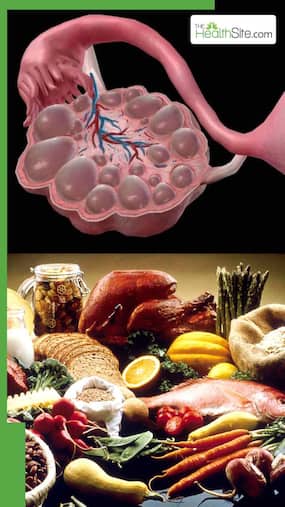 PCOS में भूलकर भी न खाएं ये 7 फूड्स