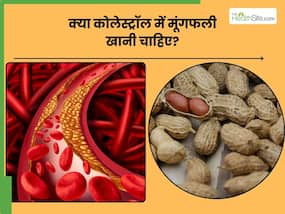 क्या मूंगफली खाने से बढ़ता है कोलेस्ट्रॉल, जानिए हाई कोलेस्ट्रॉल में मूंगफली खाने के नुकसान