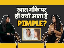 किसी खास मौके पर ही क्यों आते हैं Pimple? जानें क्या है कारण