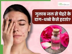 चेहरे के दाग-धब्बों से छुटकारा पाने के लिए इन 3 तरीकों से लगाएं गुलाब जल, मिलेगी नैचुरली ग्लोइंग स्किन