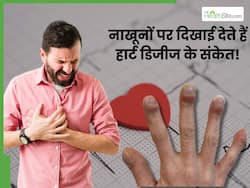 नाखूनों पर दिखने वाले इन 5 लक्षणों से समझ जाएं आने वाला है हार्ट अटैक, तुरंत करा लें जांच