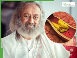 Gurudev Sri Sri Ravi Shankar Shares Tips To Control High Cholesterol: Explains How Curry Leaves Can Bring Down LDL