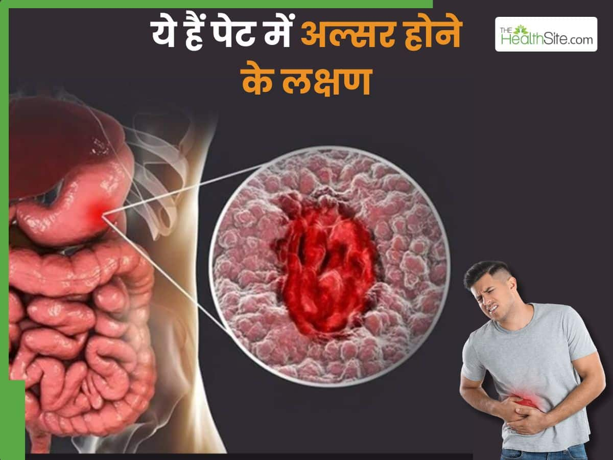 Pet Me Ulcer Ke Lakshan | पेट में अल्सर होने पर शरीर में दिखाई देते हैं ...