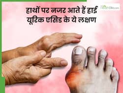 यूरिक एसिड बढ़ने पर हाथों की उंगलियों के आसपास दिखाई देते हैं ये 5 लक्षण, इस हिस्से में होता है खतरनाक दर्द