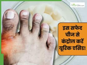 यूरिक एसिड को पेशाब के रास्ते बाहर निकाल देगी लहसुन की कलियां, बस इन 3 तरीकों से कर लें सेवन यूरिक एसिड को पेशाब के रास्ते बाहर निकाल देगी लहसुन की कलियां, बस इन 3 तरीकों से कर लें सेवन