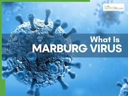 What Is Marburg Virus? Symptoms of Deadly Bleeding Eye Virus You Should Know