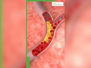 हेल्दी दिखने वाले ये 8 फूड्स भी बढ़ाते हैं शरीर में Bad Cholesterol