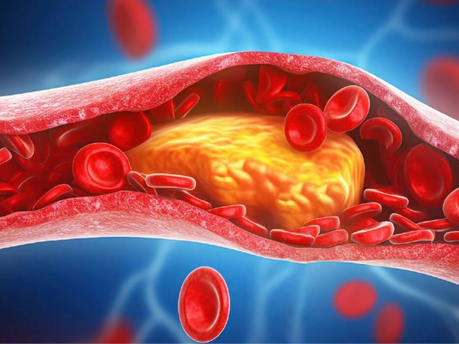 रात को सोते समय अलसी के बीजों का पाउडर खाने से दूर होंगी ये 5 समस्याएं, खराब कोलेस्ट्रॉल रहेगा कंट्रोल और कब्ज होगी दूर