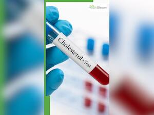 खाली पेट कोलेस्ट्रॉल लेवल कितना होना चाहिए?