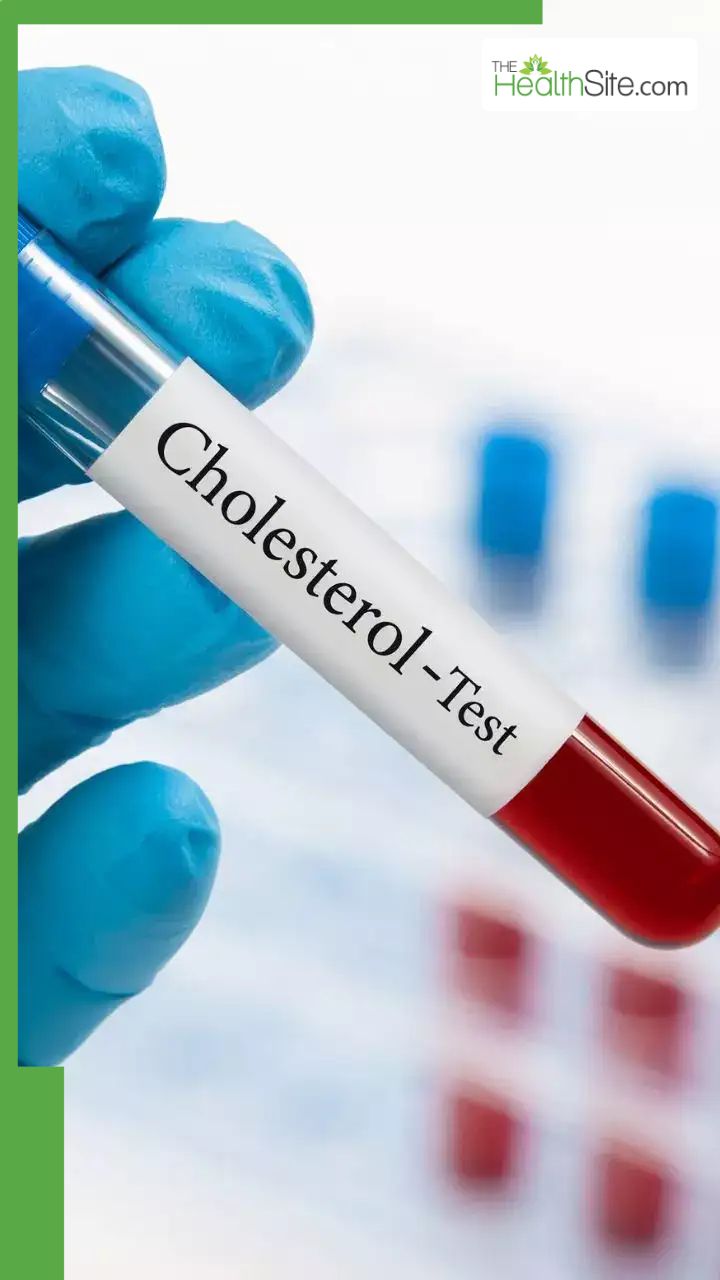 खाली पेट कोलेस्ट्रॉल लेवल कितना होना चाहिए?