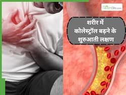 Cholesterol ke Lakshan: कोलेस्ट्रॉल बढ़ने पर शरीर में दिखाई देते हैं 5 शुरुआती संकेत, ठंडे पड़ जाते हैं पैरों के तलवे