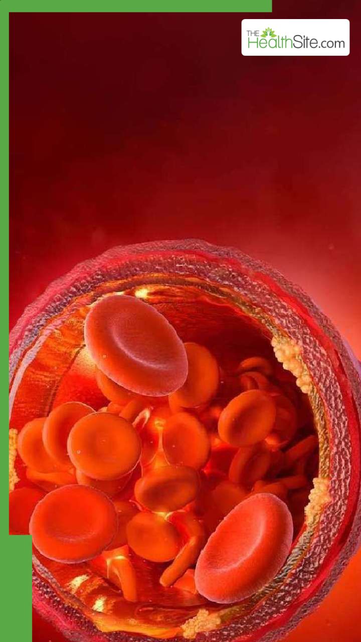 рдХреЛрд▓реЗрд╕реНрдЯреНрд░реЙрд▓ рдмрдврд╝рдиреЗ рдкрд░ рдХрд╣рд╛рдВ рджрд░реНрдж рд╣реЛрддрд╛ рд╣реИ?