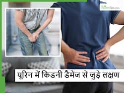 सर्दियों में यूरिन में दिखने वाले ये 5 बदलाव कहीं Kidney Damage का तो नहीं संकेत? आपको भी सावधान होने की जरूरत?