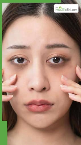 क्यों होते हैं डार्क सर्कल? जानिए 5 बड़े कारण