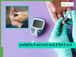 Diabetic Ulcer: डायबिटीज में इन कारणों से बन सकते हैं पैरों में छाले, जानें कैसे करें इनसे बचाव
