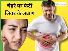 फैटी लिवर होने पर चेहरे पर नजर आते हैं ये 5 लक्षण, होने लगती हैं दाग-धब्बे और रैशेज जैसी समस्याएं फैटी लिवर होने पर चेहरे पर नजर आते हैं ये 5 लक्षण, होने लगती हैं दाग-धब्बे और रैशेज जैसी समस्याएं